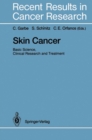 Skin Cancer: Basic Science, Clinical Research and Treatment - eBook