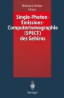 Single-Photon-Emissions-Computertomographie (SPECT) des Gehirns - eBook
