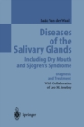 Diseases of the Salivary Glands Including Dry Mouth and Sjogren's Syndrome : Diagnosis and Treatment - eBook