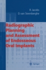 Radiographic Planning and Assessment of Endosseous Oral Implants - eBook