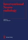 Interventional Neuroradiology - eBook