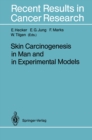 Skin Carcinogenesis in Man and in Experimental Models - eBook