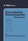 Generalisierte Tendomyopathie (Fibromyalgie) - Book