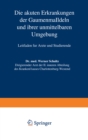 Die akuten Erkrankungen der Gaumenmandeln und ihrer unmittelbaren Umgebung : Leitfaden fur Arzte und Studierende - eBook