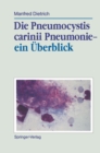 Die Pneumocystis carinii Pneumonie- ein Uberblick - eBook