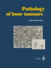 Pathology of bone tumours : Personal experience - eBook