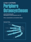 Periphere Osteosynthesen : unter Verwendung des Kleinfragment-Instrumentariums der AO - eBook