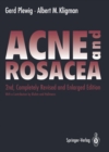ACNE and ROSACEA - eBook