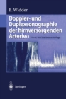 Doppler- und Duplexsonographie der hirnversorgenden Arterien - eBook