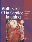 Multi-slice CT in Cardiac Imaging : Technical Principles, Imaging Protocols, Clinical Indications and Future Perspective - eBook