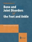 Bone and Joint Disorders of the Foot and Ankle : A Rheumatological Approach - Book