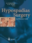 Hypospadias Surgery : An Illustrated Guide - Book