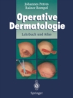 Operative Dermatologie : Lehrbuch und Atlas - eBook
