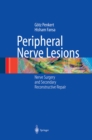 Peripheral Nerve Lesions : Nerve Surgery and Secondary Reconstructive Repair - eBook