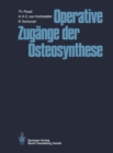 Operative Zugange der Osteosynthese - eBook