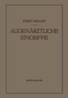 Augenarztliche Eingriffe : Ein Kurzes Handbuch fur Angehende Augenarzte - eBook