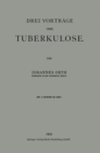 Drei Vortrage uber Tuberkulose - eBook