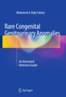 Rare Congenital Genitourinary Anomalies : An Illustrated Reference Guide - eBook