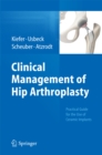 Clinical Management of Hip Arthroplasty : Practical Guide for the Use of Ceramic Implants - eBook