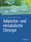 Adipositas- und metabolische Chirurgie - eBook