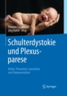 Schulterdystokie und Plexusparese : Klinik, Pravention, Gutachten und Dokumentation - eBook