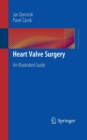 Heart Valve Surgery : An Illustrated Guide - Book