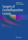 Surgery of Cerebellopontine Lesions - Book