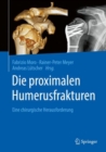 Die proximalen Humerusfrakturen : Eine chirurgische Herausforderung - eBook