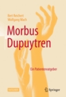 Morbus Dupuytren : Ein Patientenratgeber - eBook