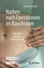 Narben nach Operationen im Bauchraum : Selbsthilfe mit dem Liedler-Konzept - eBook