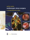 Endoscopic Sinus Surgery : A Comprehensive Atlas - eBook
