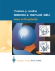 Knee Arthroplasty - eBook