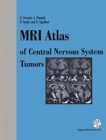 MRI Atlas of Central Nervous System Tumors - Book