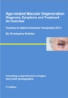 Age-related macular degeneration : Diagnosis, symptoms and treatment, an overview - eBook