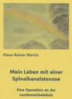 Mein Leben mit einer Spinalkanalstenose : Eine Operation an der Lendenwirbelsaule - eBook