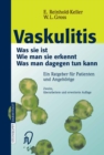 Vaskulitis : Was ist sie - Wie man sie erkennt - Was man dagegen tun kann - eBook