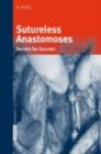 Sutureless Anastomoses : Secrets for Success - eBook