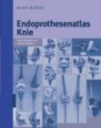 Endoprothesenatlas Knie - eBook