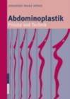 Abdominoplastik : Prinzip und Technik - eBook