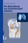 Die Behandlung von Gelenkknorpeldefekten - eBook