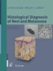Histological Diagnosis of Nevi and Melanoma - eBook