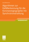 Algorithmen zur Gefaerkennung fur die Koronarangiographie mit Synchrotronstrahlung - eBook