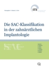 Die SAC-Klassifikation in der zahnarztlichen Implantologie - eBook