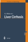 Liver Cirrhosis - eBook
