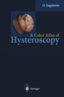 A Color Atlas of Hysteroscopy - eBook
