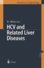 HCV and Related Liver Diseases - eBook