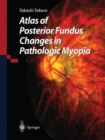 Atlas of Posterior Fundus Changes in Pathologic Myopia - Book