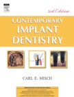 Contemporary Implant Dentistry - Book