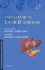 Understanding Liver Disorders - e-Book - eBook