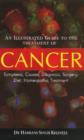 Illustrated Guide to the Treatment of Cancer : Symptoms, Causes, Diagnosis, Surgery, Diet, Homeopathic Treatment - Book